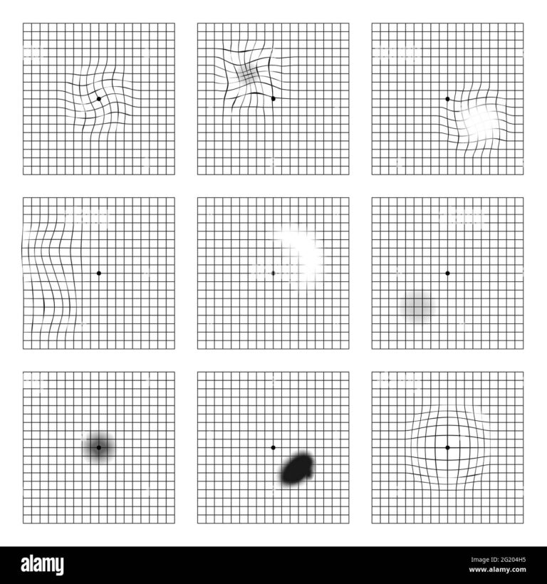 Amsler Eye Test Grid Oculist Vector Printable Chart Retina Examination Grid With Dot In Centre Vision Control Stock Vector Image Art Alamy