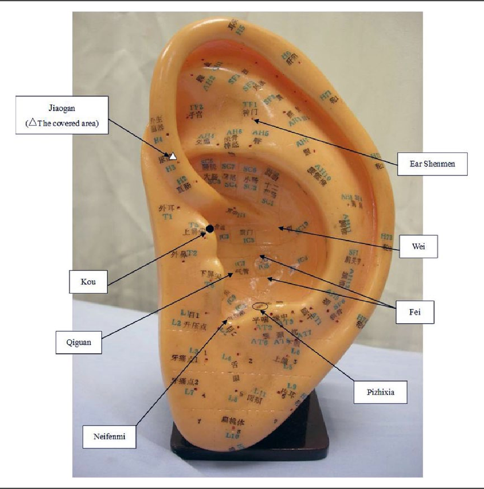 Figure 2 From Effectiveness Of Acupuncture For Smoking Cessation In A Chinese Population Semantic Scholar
